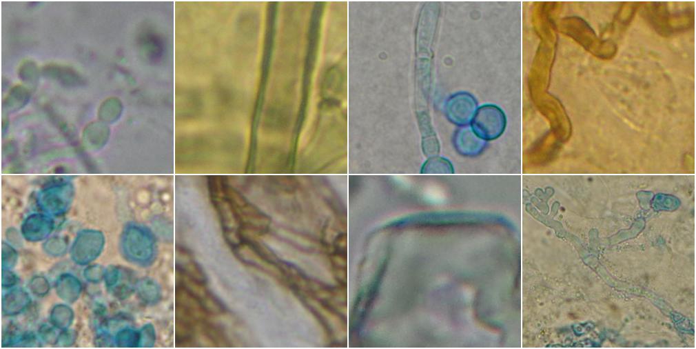 Collage of microscopic fungi images